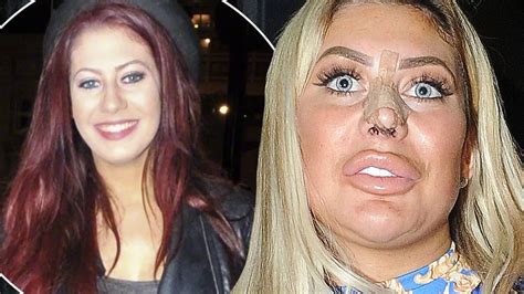 chloe ferry then and now|chloe ferry recent photos.